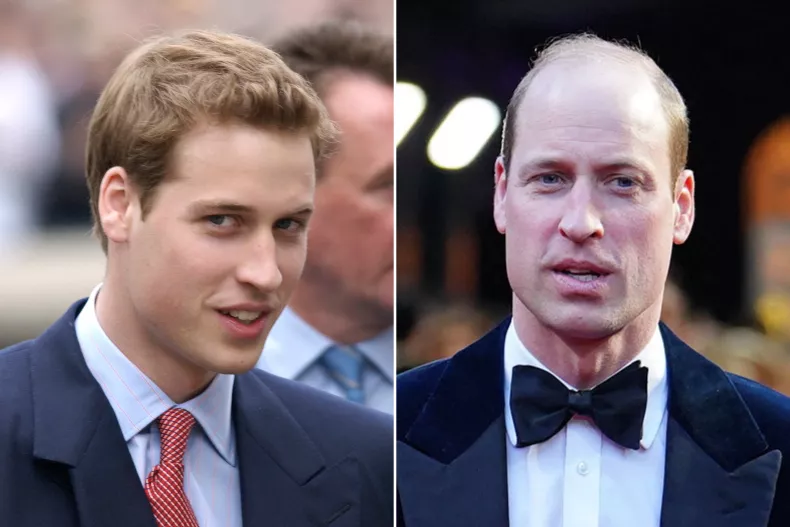 Prince William's 'Forever Young' Transformation Goes Viral